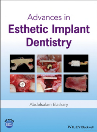 Image of Advances in Esthetic Implant Dentistry