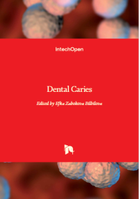 Image of Dental Caries