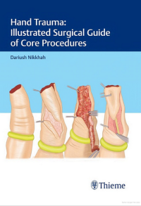 Image of Hand Trauma: Illustrated Surgical Guide of Core Procedures