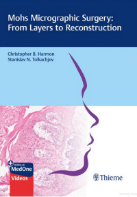 Image of Mohs Micrographic Surgery : From Layers to Reconstruction