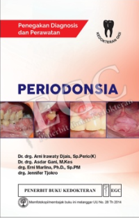 Image of Penegakan Diagnosis Dan Perawatan Periodonsia
