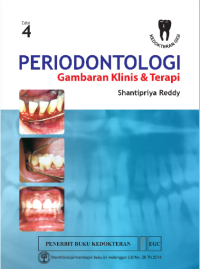Image of Periodontologi Gambaran klinis & Terapi