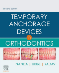 Image of Temporary Anchorage Devices in Orthodontics