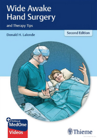 Image of Wide Awake Hand Surgery and Therapy Tips